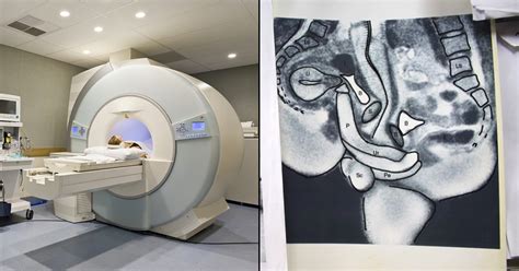 An inside view of sex: MRI scanner captures intercourse as you。